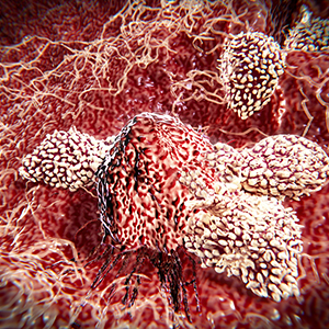 Cancer Immunotherapies Continue to Make Headway