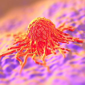 Fine-Tuning Treatments for Triple-Negative Breast Cancer