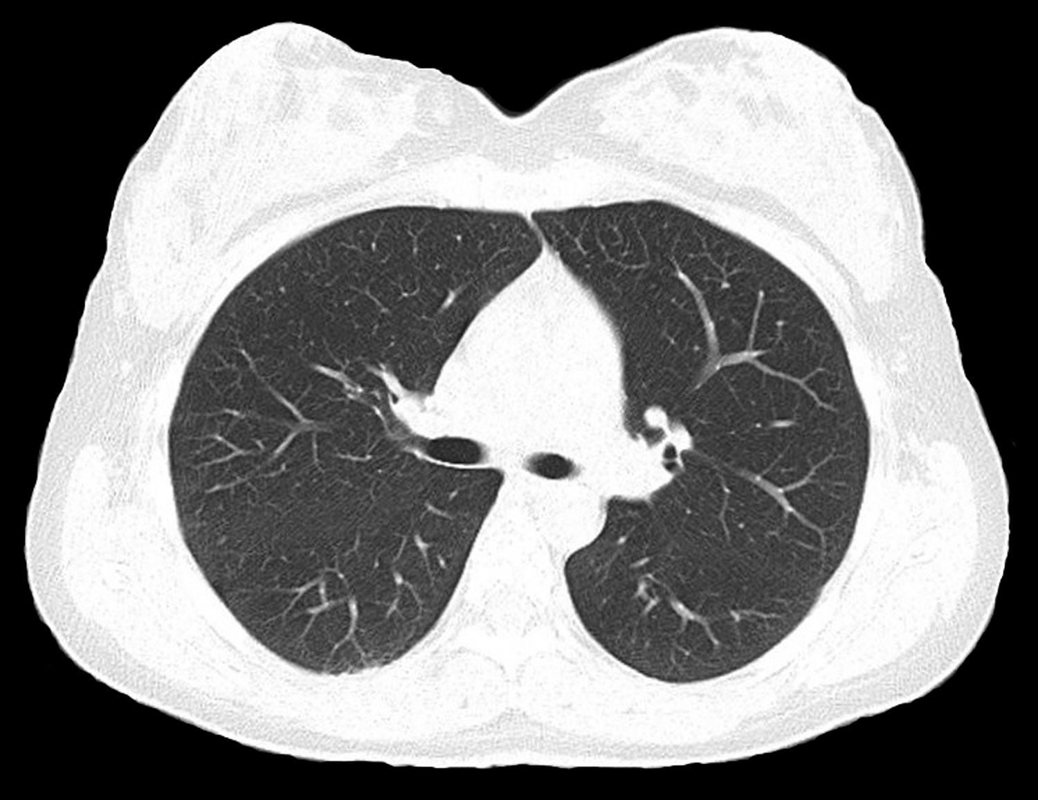 Non–Small Cell Lung Cancer Takes Center Stage