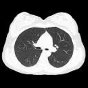 Non–Small Cell Lung Cancer Takes Center Stage