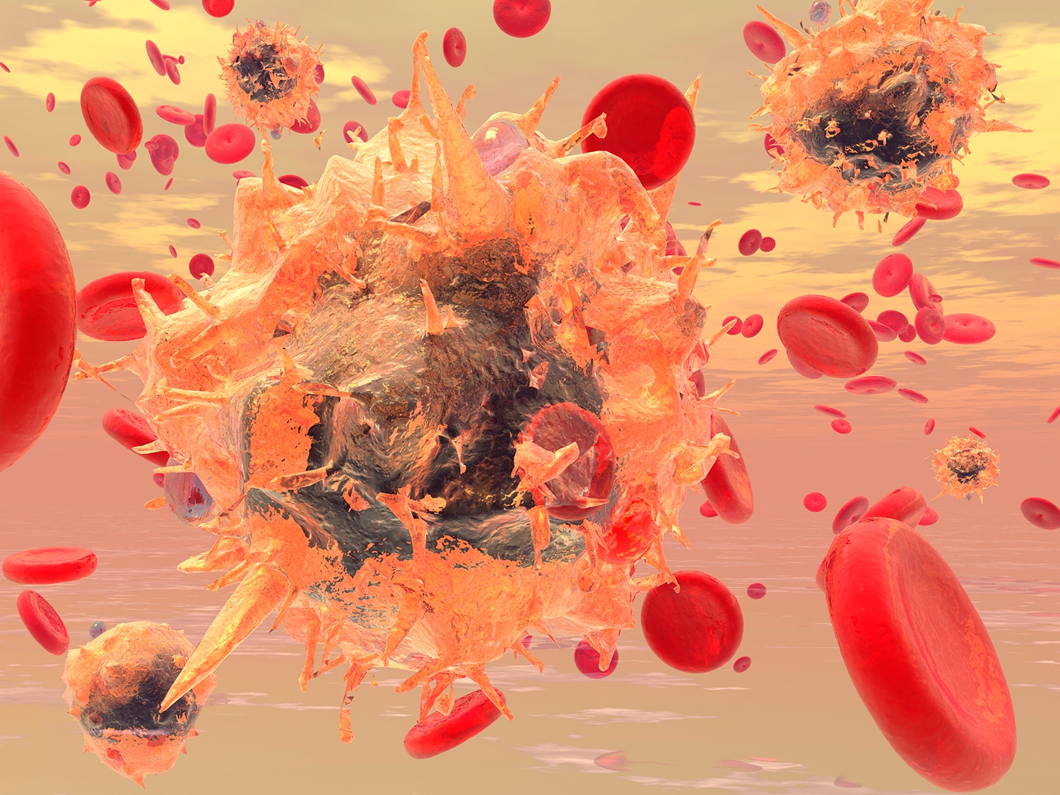 CAR-T Cells: ‘Bionic’ Immune Cells for Treating Cancer