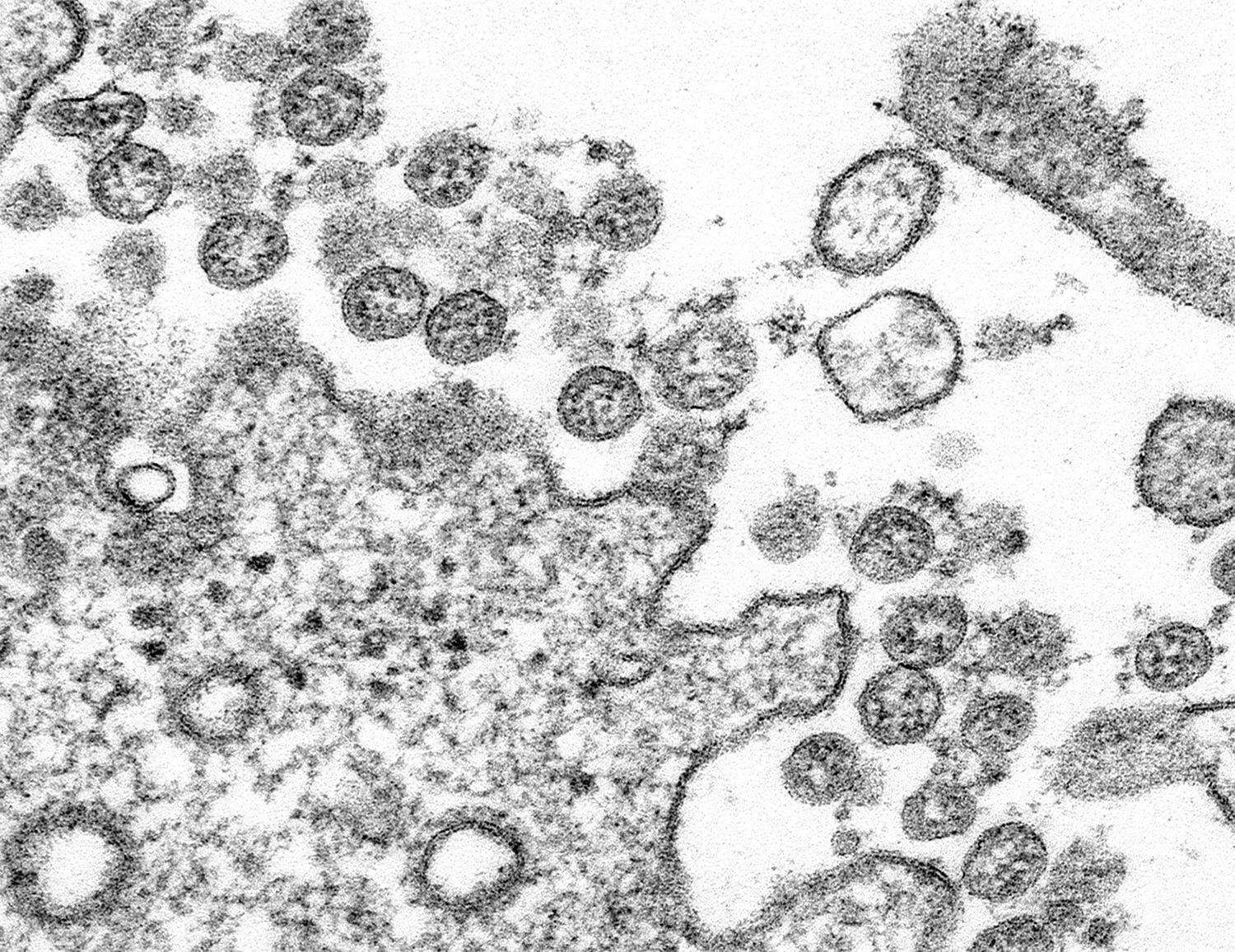 The Coronavirus and Cancer Care