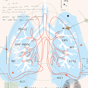 More Choices to Treat Lung Cancer