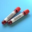 Liquid Biopsies May Ease Enrollment in Clinical Trials