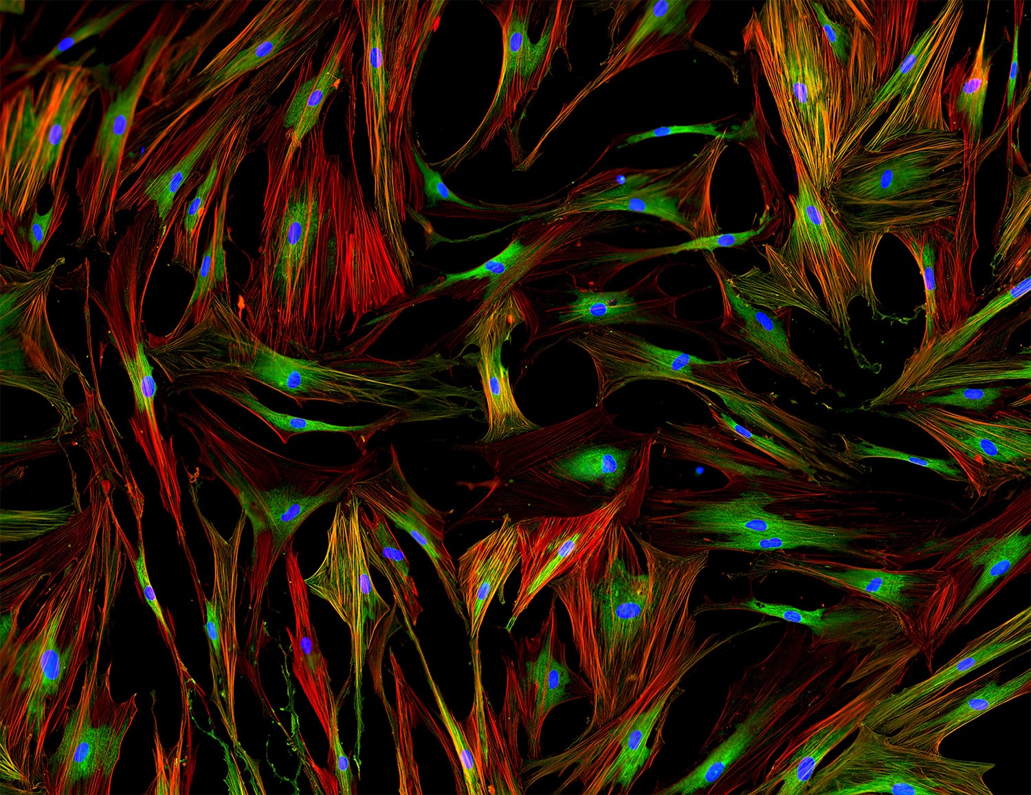 The Tumor Microenvironment