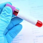 Blood Test Could Predict Cancer Recurrence and Treatment Side Effects