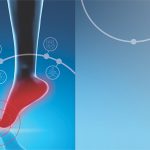 Controlling Peripheral Neuropathy