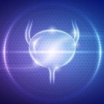 Combination Therapy in Advanced Bladder Cancer