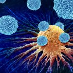 Immunotherapy Improves Results in Head and Neck Cancer