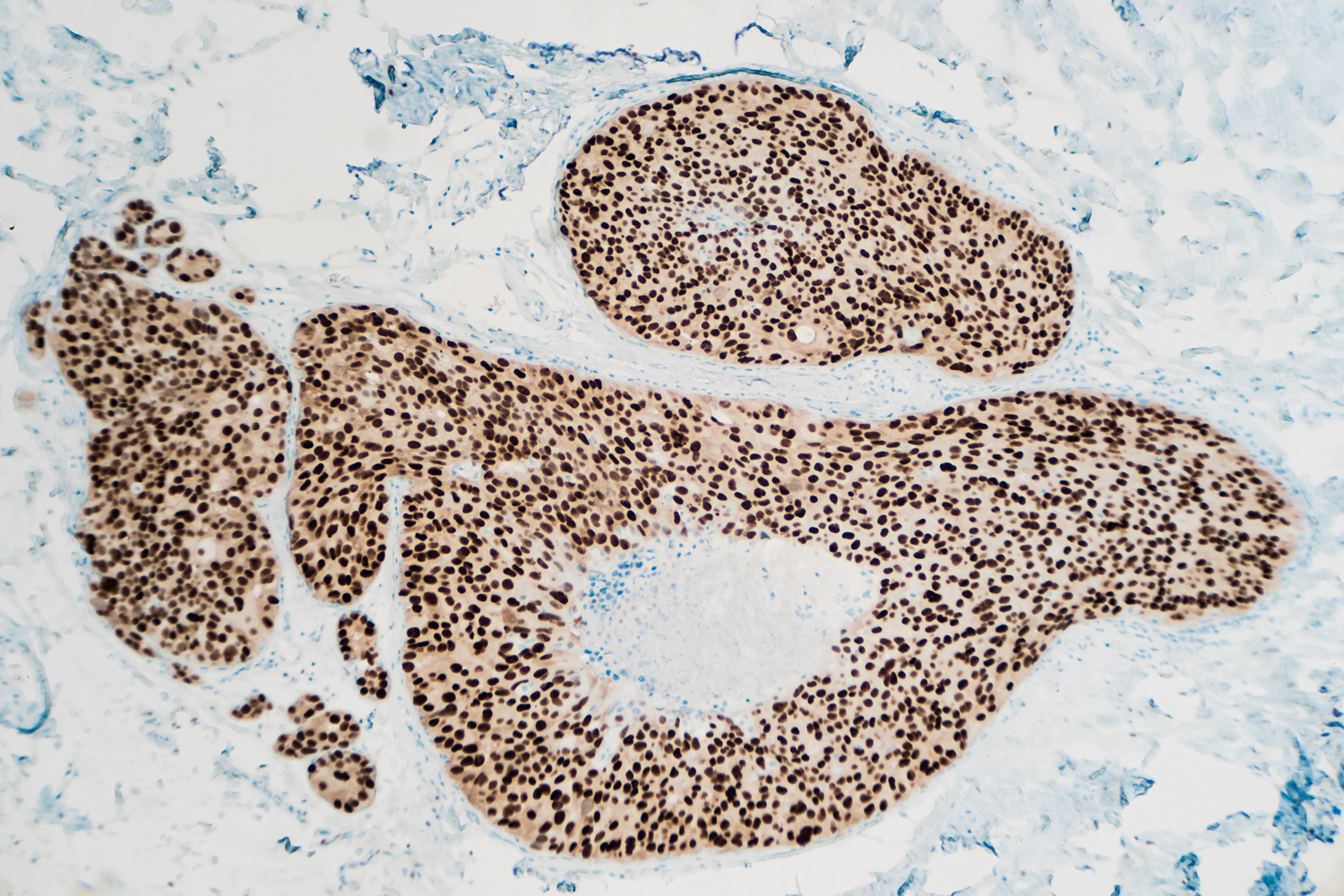 May 30: The Week in Cancer News