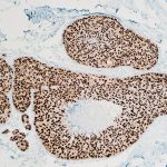 May 30: The Week in Cancer News
