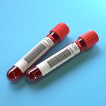 Tissue and Liquid Biopsy for Targeted Therapy