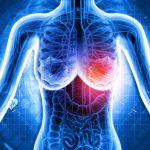 Treatment Harnesses Light to Target Cancer