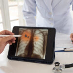 July 11: The Week in Cancer News