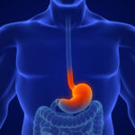 Immunotherapy for Early-stage Gastric Cancer