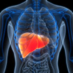 August 1: The Week in Cancer News