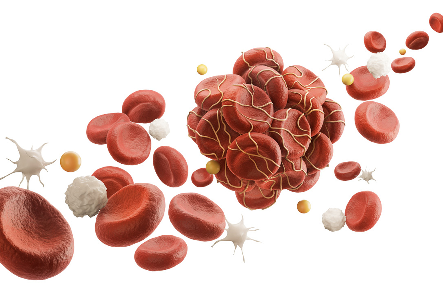 A Safer Way to Prevent Blood Clots