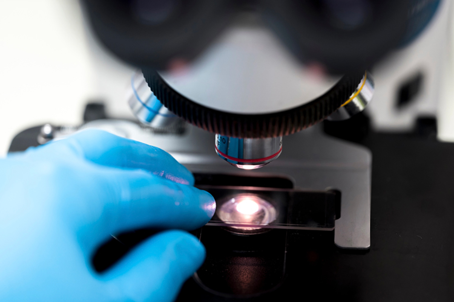 Reducing Sexual Side Effects From Prostate Cancer Surgery