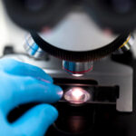 Reducing Sexual Side Effects From Prostate Cancer Surgery