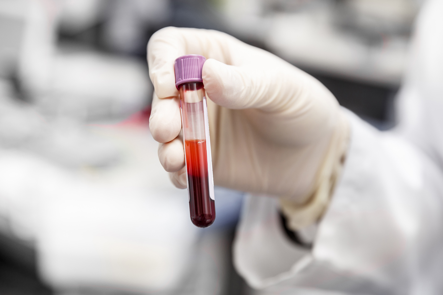 September 5: The Week in Cancer News