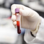 September 5: The Week in Cancer News