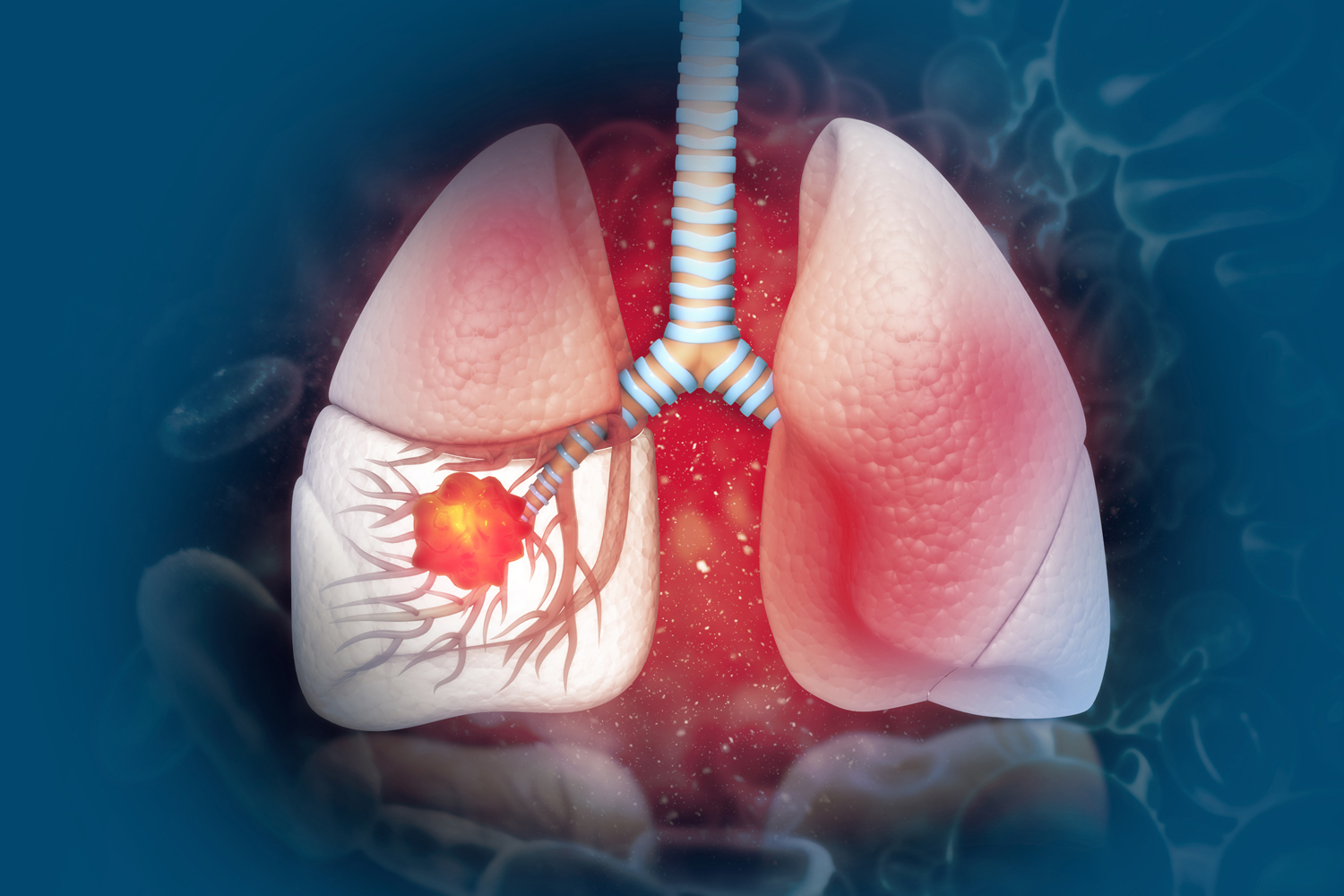September 12: The Week in Cancer News
