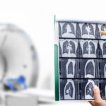 November 21: The Week in Cancer News