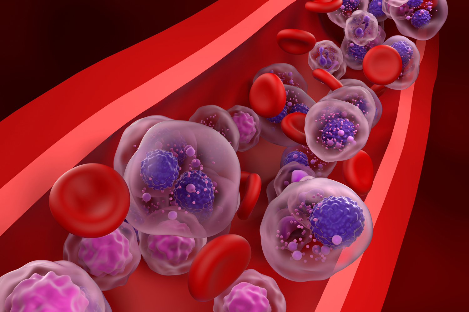First-ever Treatment Approved for Smoldering Myeloma Comes With Questions