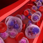 First-ever Treatment Approved for Smoldering Myeloma Comes With Questions