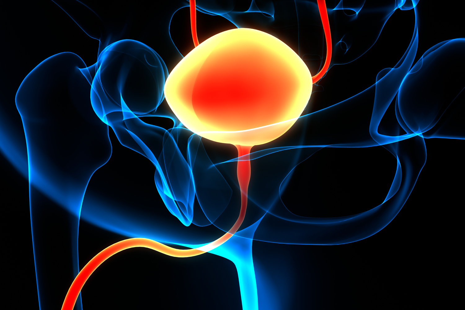 Treatments Offer Nonsurgical Path to Bladder Preservation