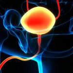 Treatments Offer Nonsurgical Path to Bladder Preservation