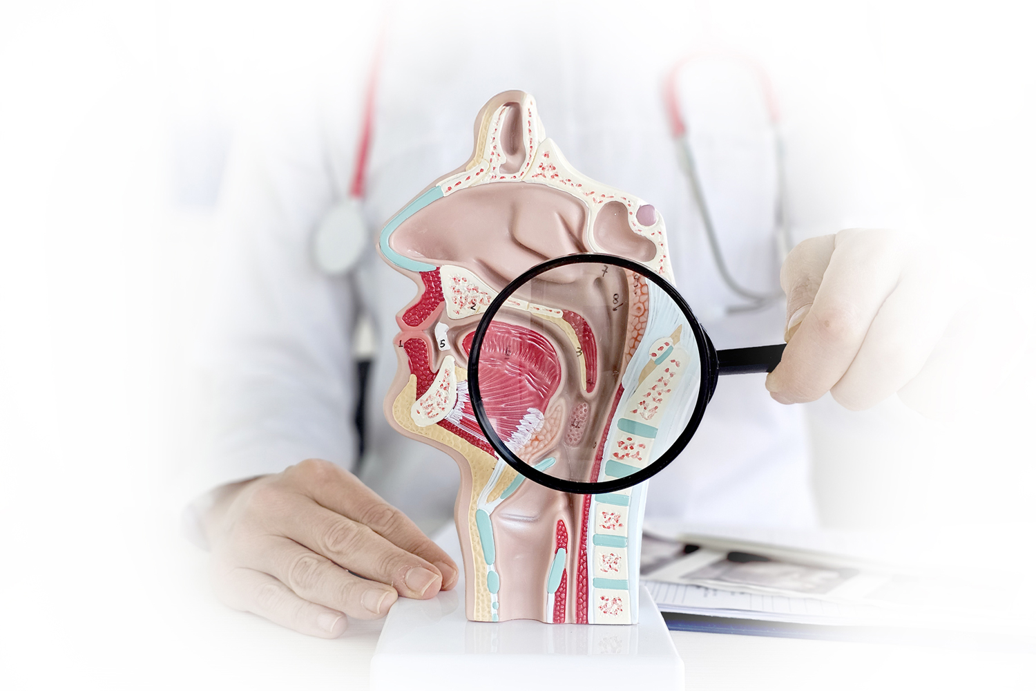 Limiting Chemotherapy in Nasopharyngeal Cancer