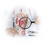 Limiting Chemotherapy in Nasopharyngeal Cancer