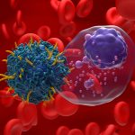 CAR T-cell Therapy Prevents Progression in High-risk Smoldering Myeloma