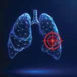 Targeted Therapy Prompts Responses in KRAS-mutated Lung Cancer