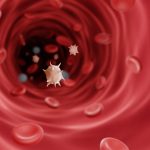 Maintaining Platelet Counts During Chemotherapy