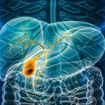 The Week in Cancer News: Cholangiocarcinoma Therapy and Lung Cancer Treatment Rates