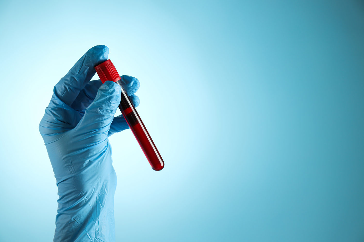What Are Liquid Biopsies?