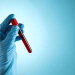 What Are Liquid Biopsies?