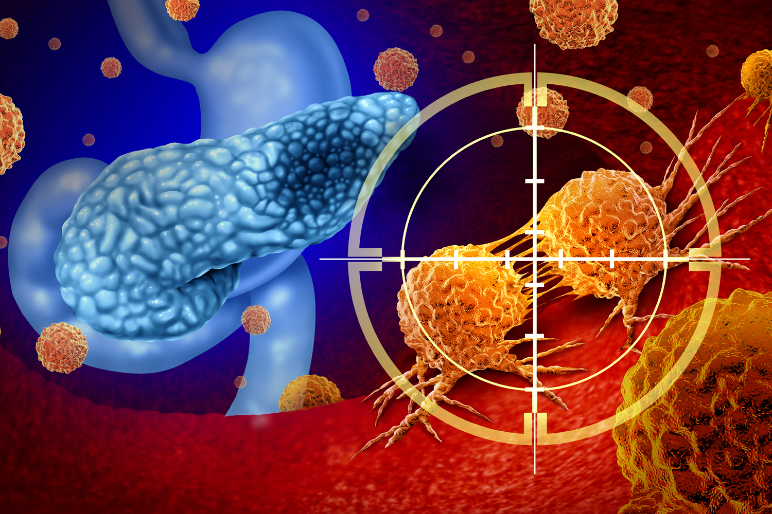 The Week in Cancer News: Pancreatic Cancer Drug Approval
