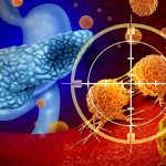 The Week in Cancer News: Pancreatic Cancer Drug Approval