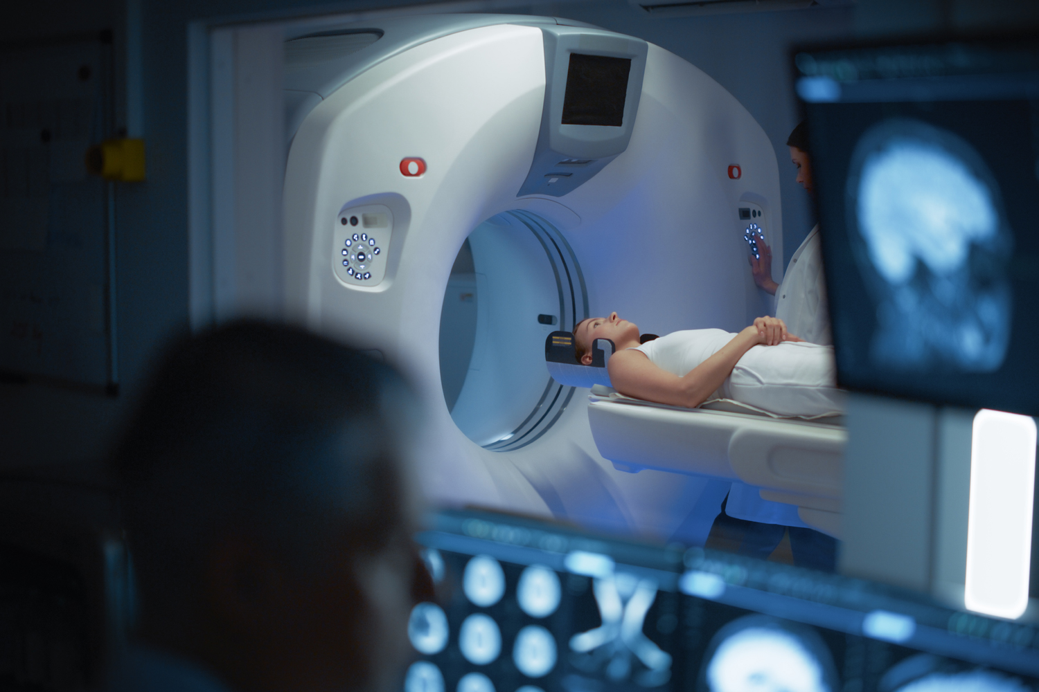 The Week in Cancer News: Brain MRI in Small Cell Lung Cancer