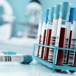The Week in Cancer News: Multi-cancer Detection Blood Test