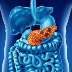 Targeted Therapy Improves Pancreatic Cancer Survival