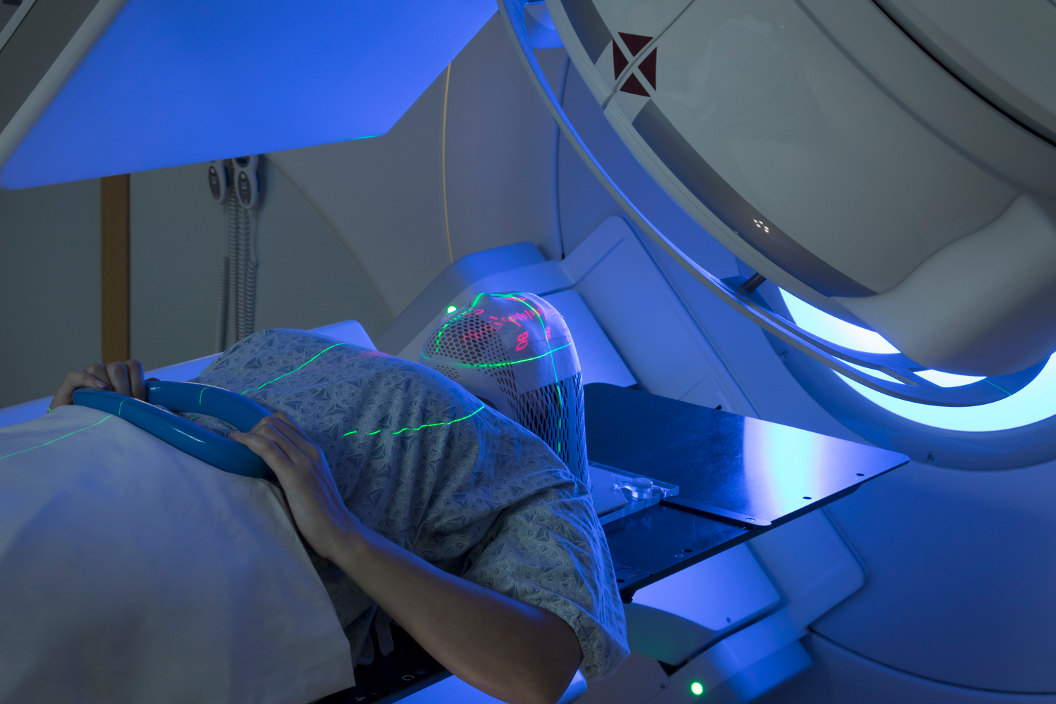 The Week in Cancer News: Splitting Radiation Doses for Brain Metastases